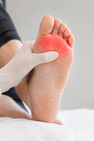 Metatarsalgia pain and inflammation in the ball of the foot